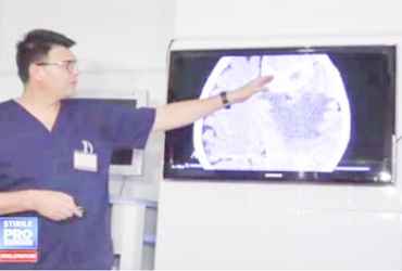 Medicii neurochirurgi din Targu Mures - aparat performant de neuronavigatie