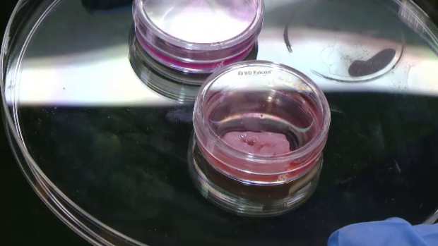 ureche imprimata cu imprimanta biologica 3d